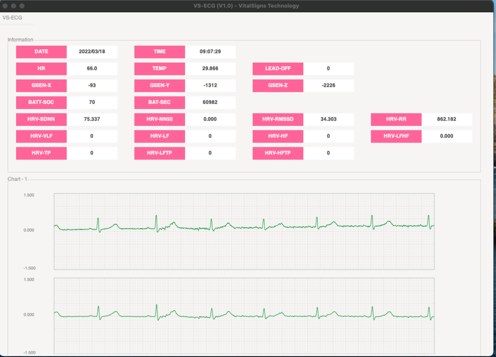 VS-ECG